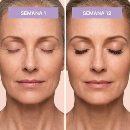 Sérum para Pestanas Velmadora™ – Pestanas Mais Longas, Densas e Fortes